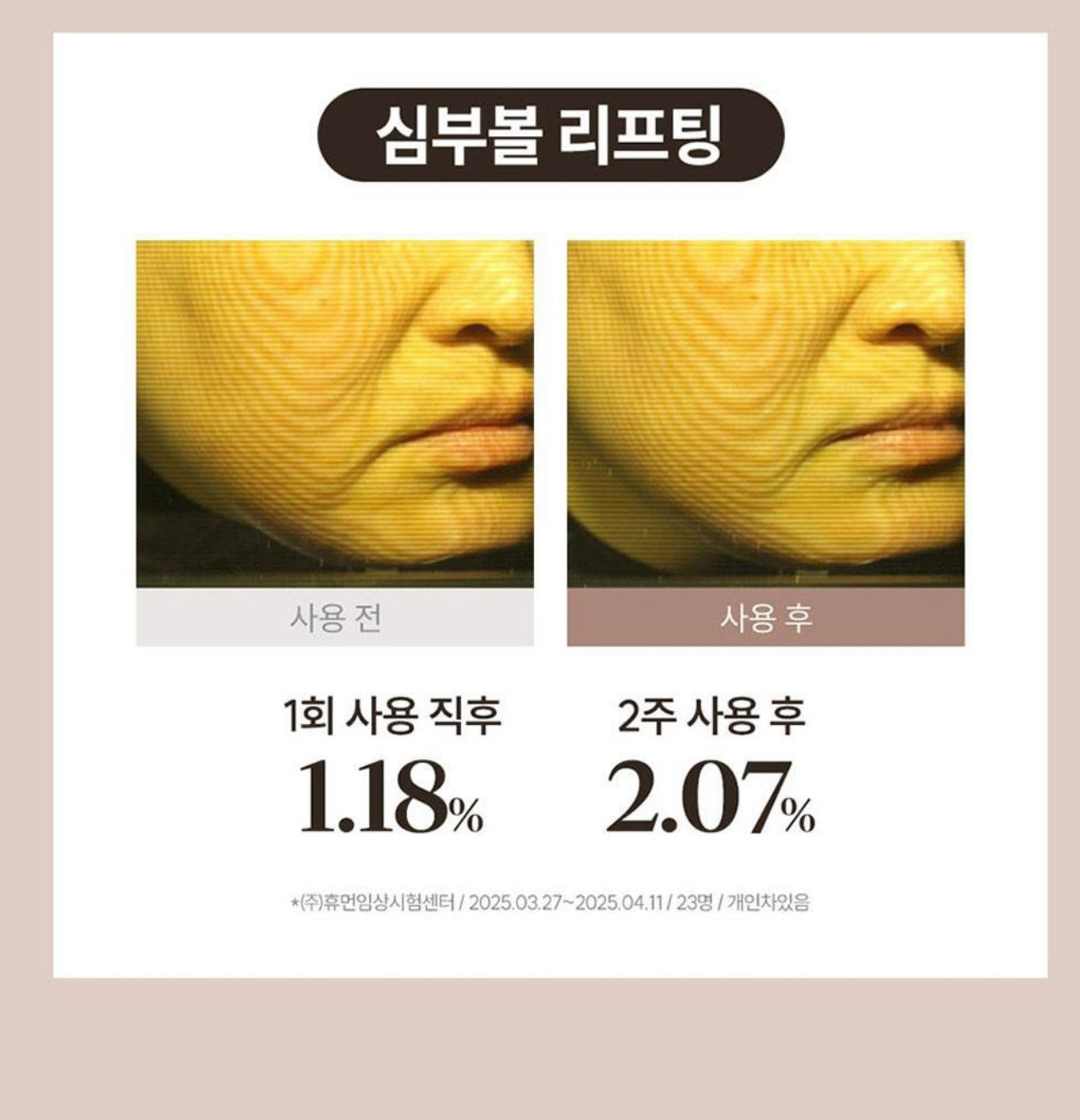 Marssique 抗皺修護貼片|眼周細紋・法令紋集中护理|韓國人氣局部緊緻貼