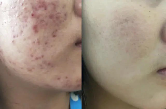 [日用輕鬆護膚]Mediheal強效棉片