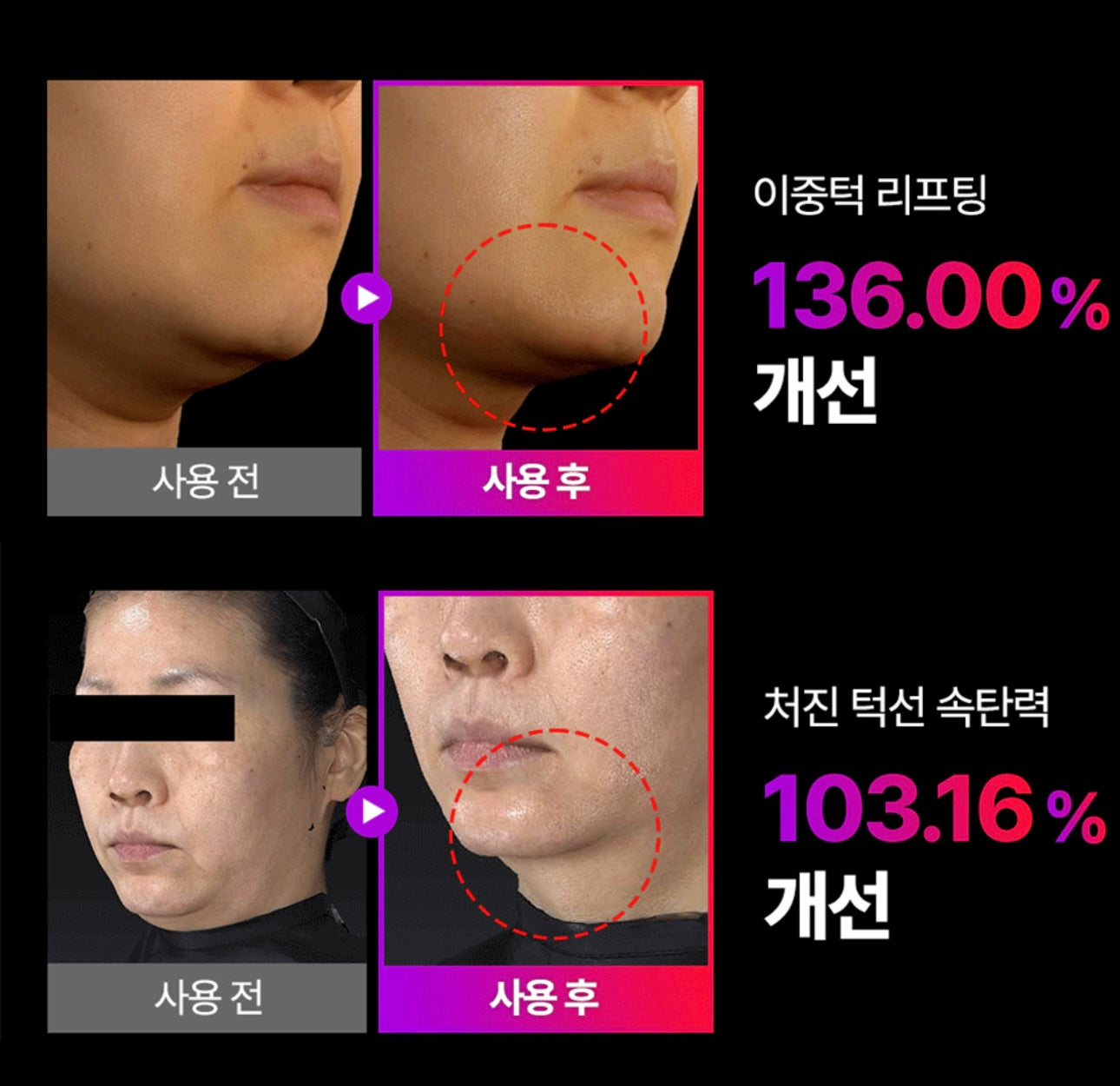 [Cortis同款]現貨EMS V-Thera瘦面緊緻美容儀