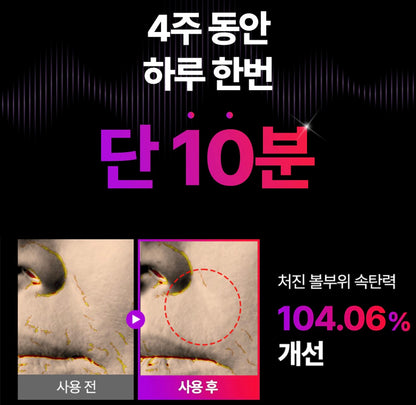 [Cortis同款]現貨EMS V-Thera瘦面緊緻美容儀