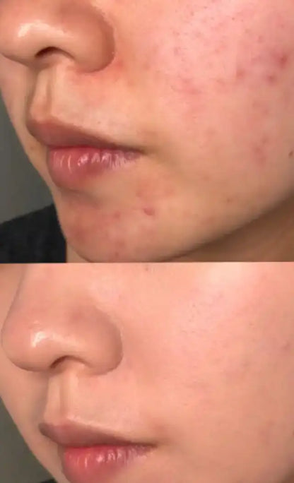 [熱門面膜]Numbuzin面膜10片裝