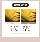 Marssique 抗皺修護貼片｜眼周細紋・法令紋集中护理｜韓國人氣局部緊緻貼