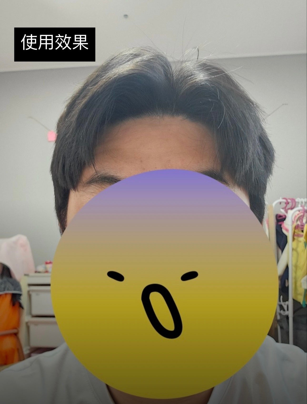 [空氣波浪髮型]頭頂蓬鬆感神器