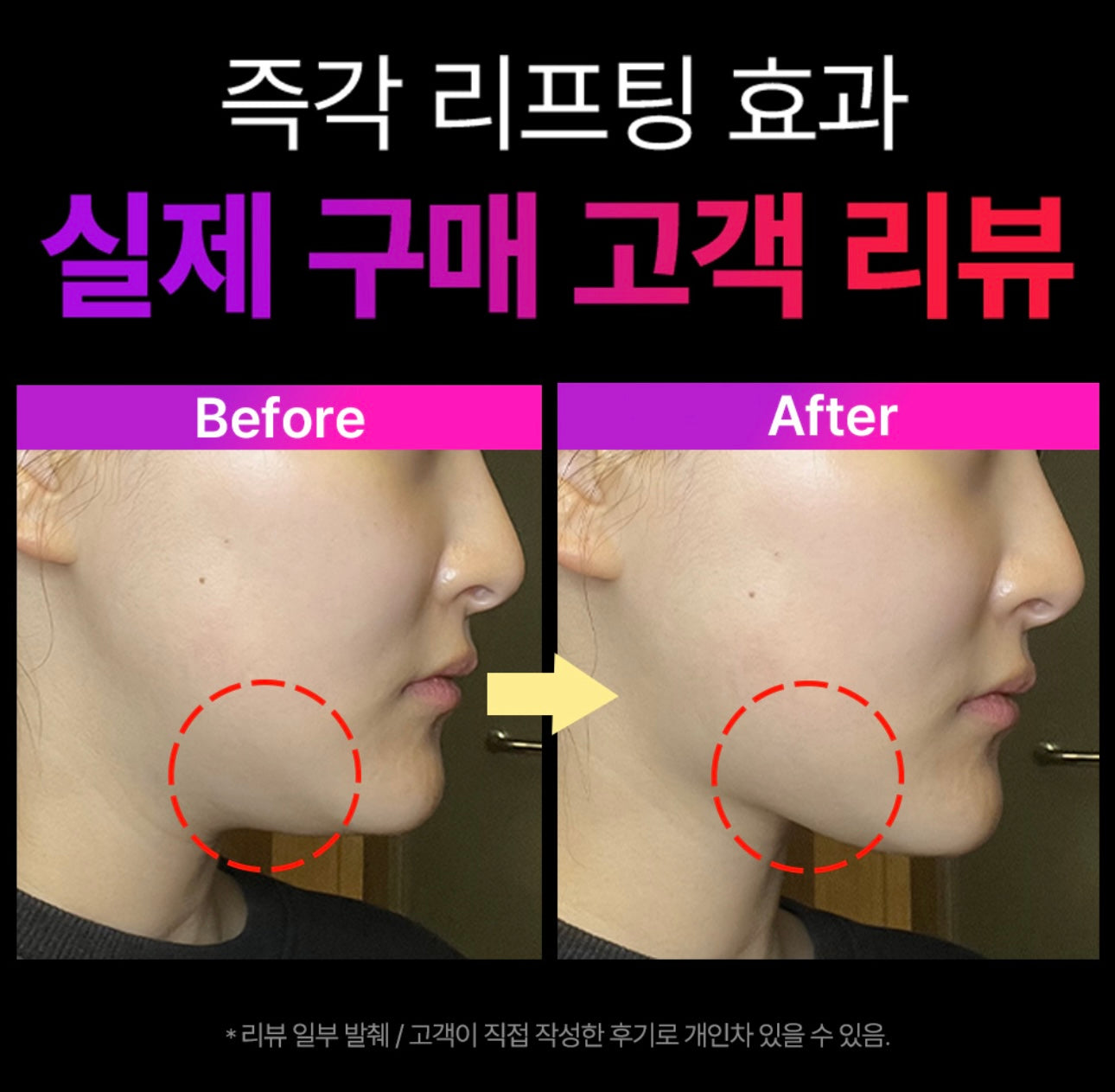 [Cortis同款]現貨EMS V-Thera瘦面緊緻美容儀