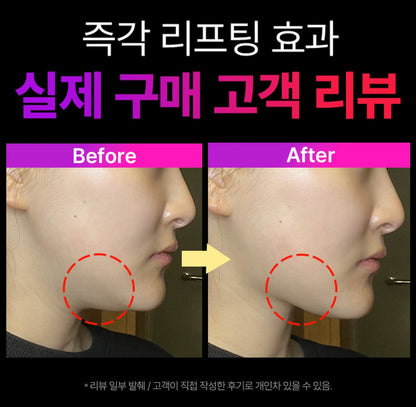 [Cortis同款]現貨EMS V-Thera瘦面緊緻美容儀