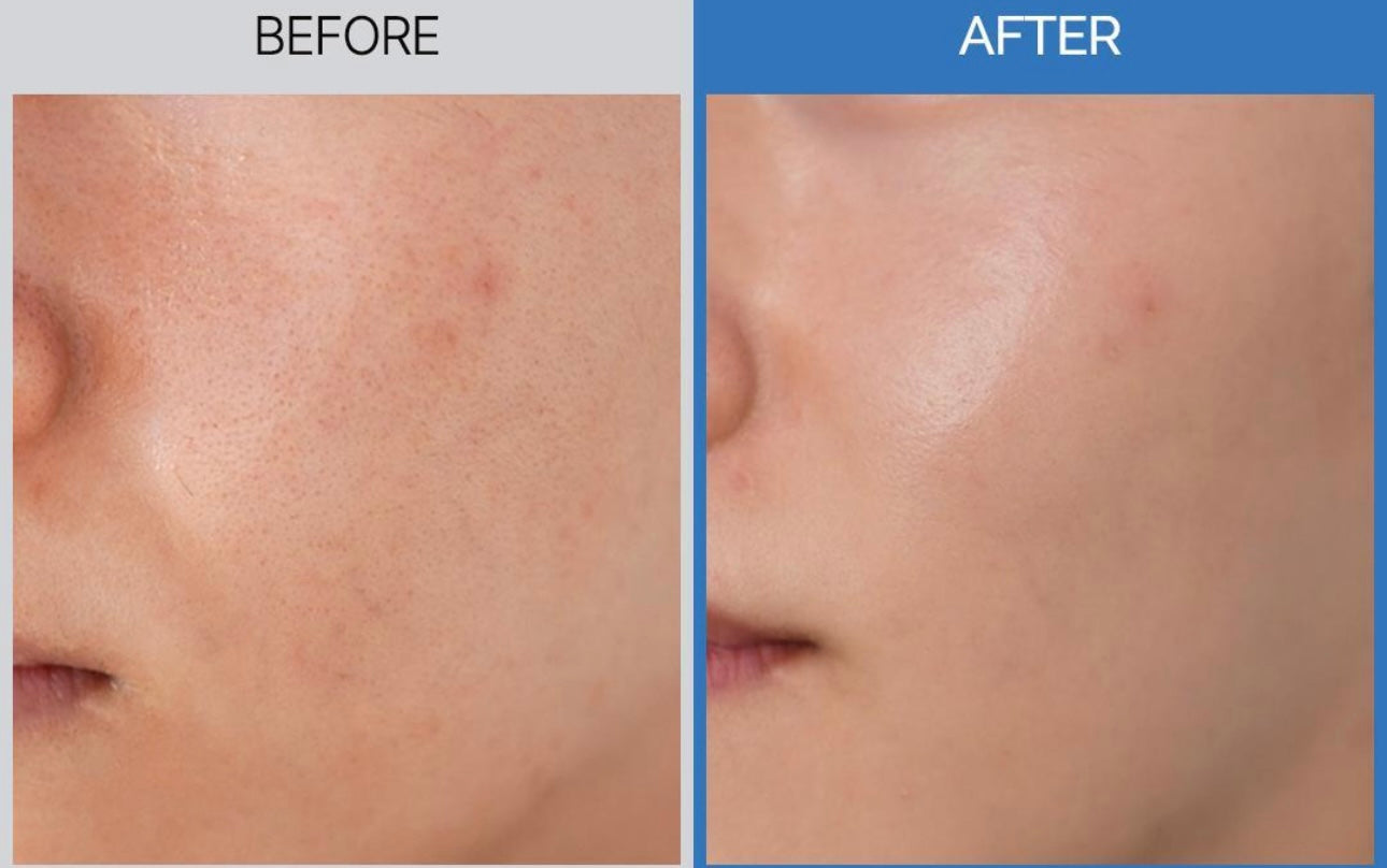 [痘痘byebye]韓國DoingWhat防曬膏SPF50