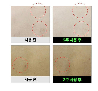 [背部暗瘡]Fation消背痘身體粗糙顆粒噴霧