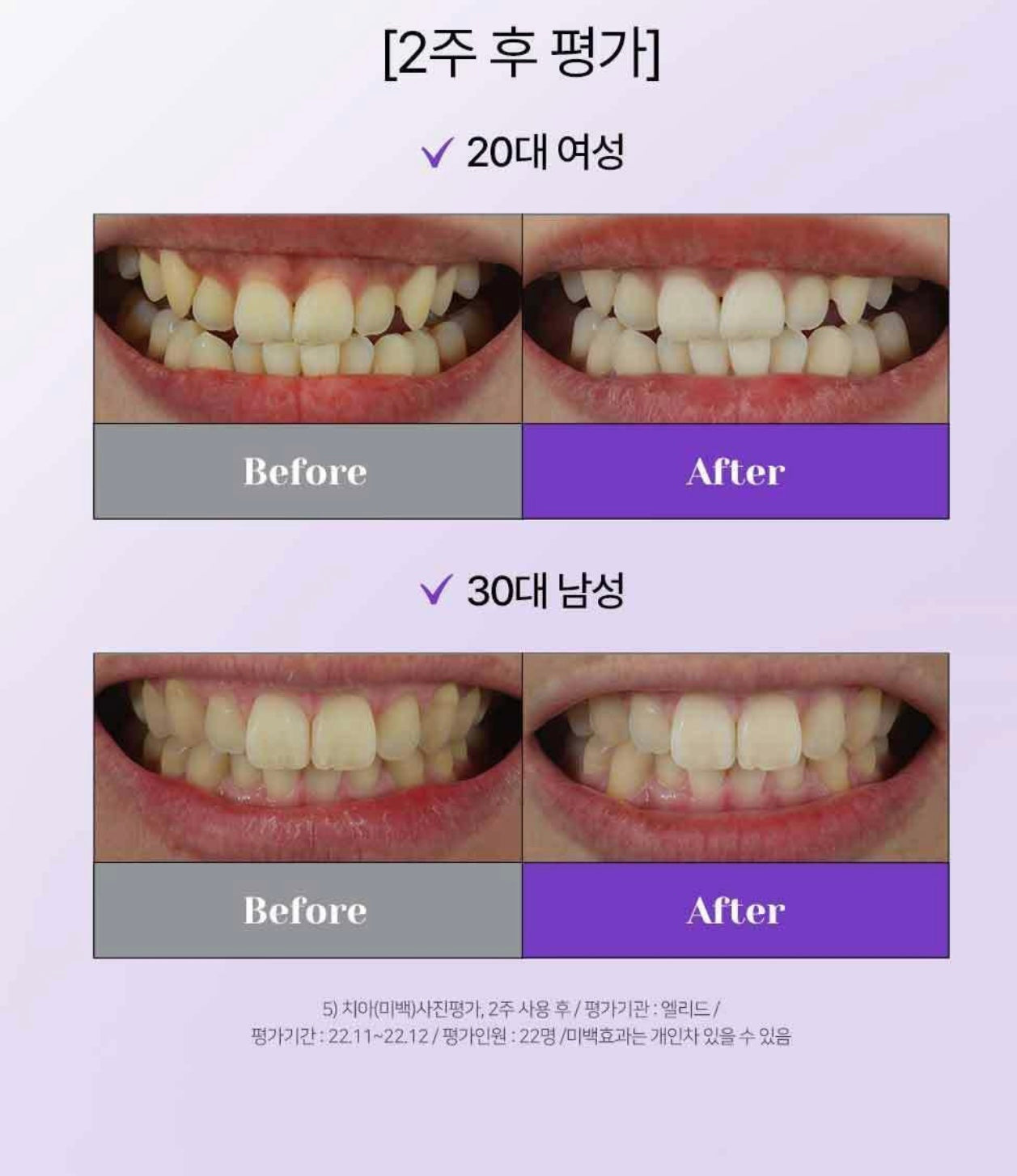 [超強去口氣]Euthymol清爽感牙膏