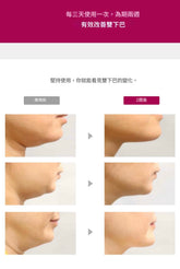 [V面消腫]ANACIS塑形瘦臉緊緻繃帶