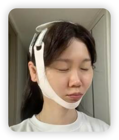 [V面消腫]ANACIS塑形瘦臉緊緻繃帶