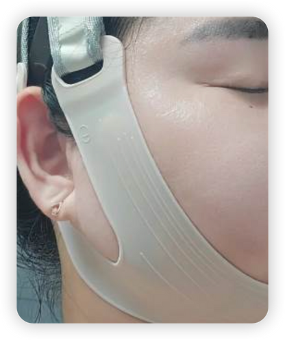 [V面消腫]ANACIS塑形瘦臉緊緻繃帶